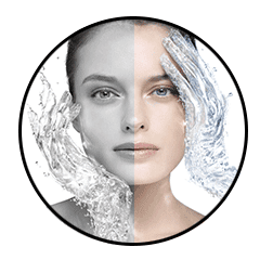 Rhinoplastie